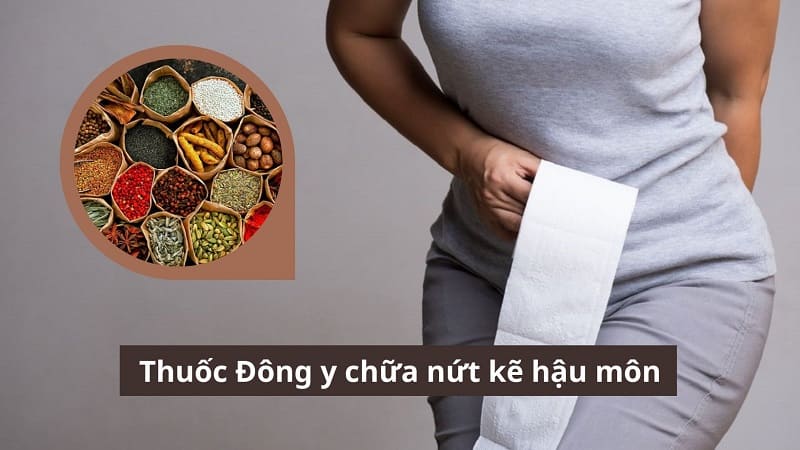 Dùng thuốc Đông y chữa nứt kẽ hậu môn có hiệu quả không?