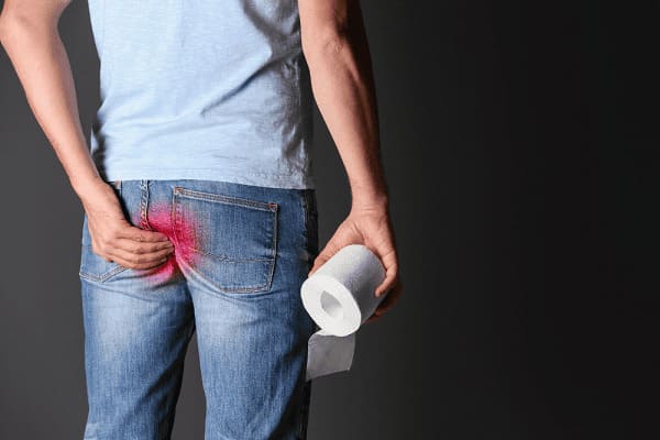 5 cách vệ sinh hậu môn khi bị nứt kẽ hiệu quả, an toàn